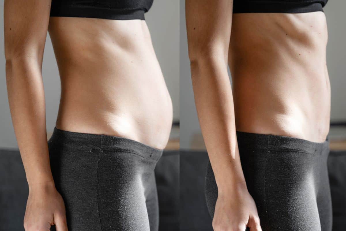 Post-Pregnancy: What Happens to Your Abdominal Muscles After Birth Waltham Cross