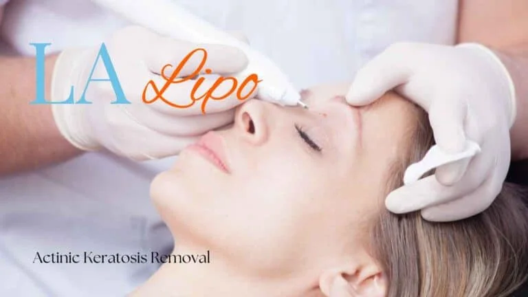 Woman receiving Actinic Keratosis Removal Treatment Waltham Cross