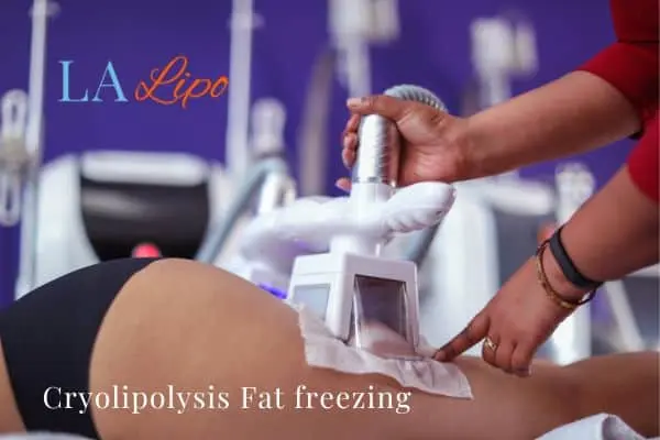 women getting fat freezing Waltham Cross