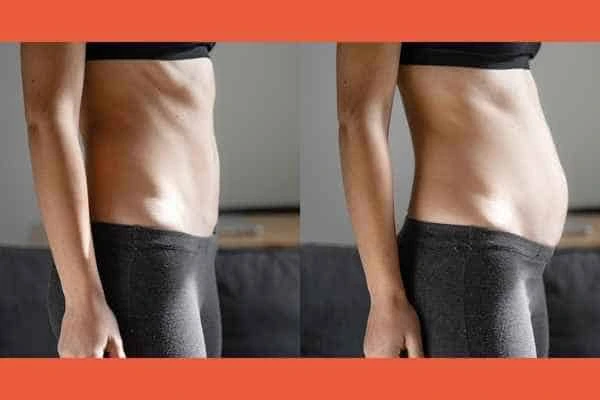 LA-EMS Body Sculpting results Waltham Cross