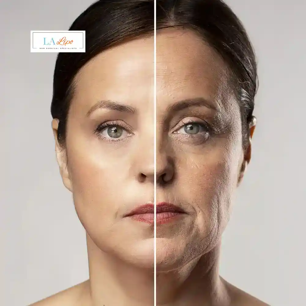 How Can You Tell If Non-Surgical Skin Tightening Is Right for You Waltham Cross?