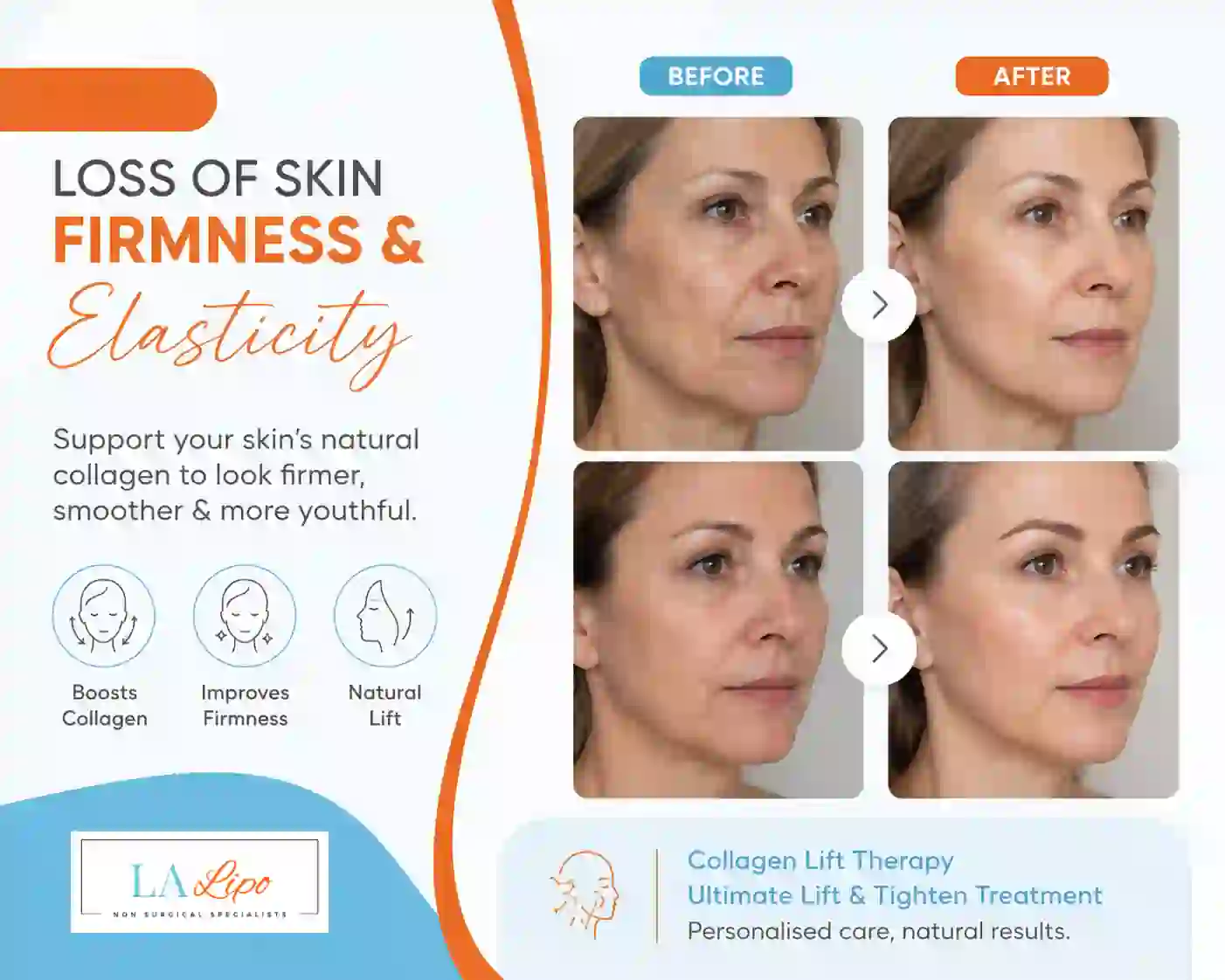 Sign #7: Loss of Skin Firmness and Elasticity Waltham Cross