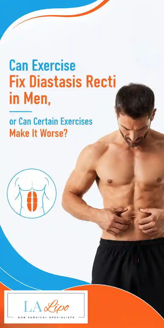 Can Exercise Fix Diastasis Recti in Men, or Can Certain Exercises Make It Worse Waltham Cross?