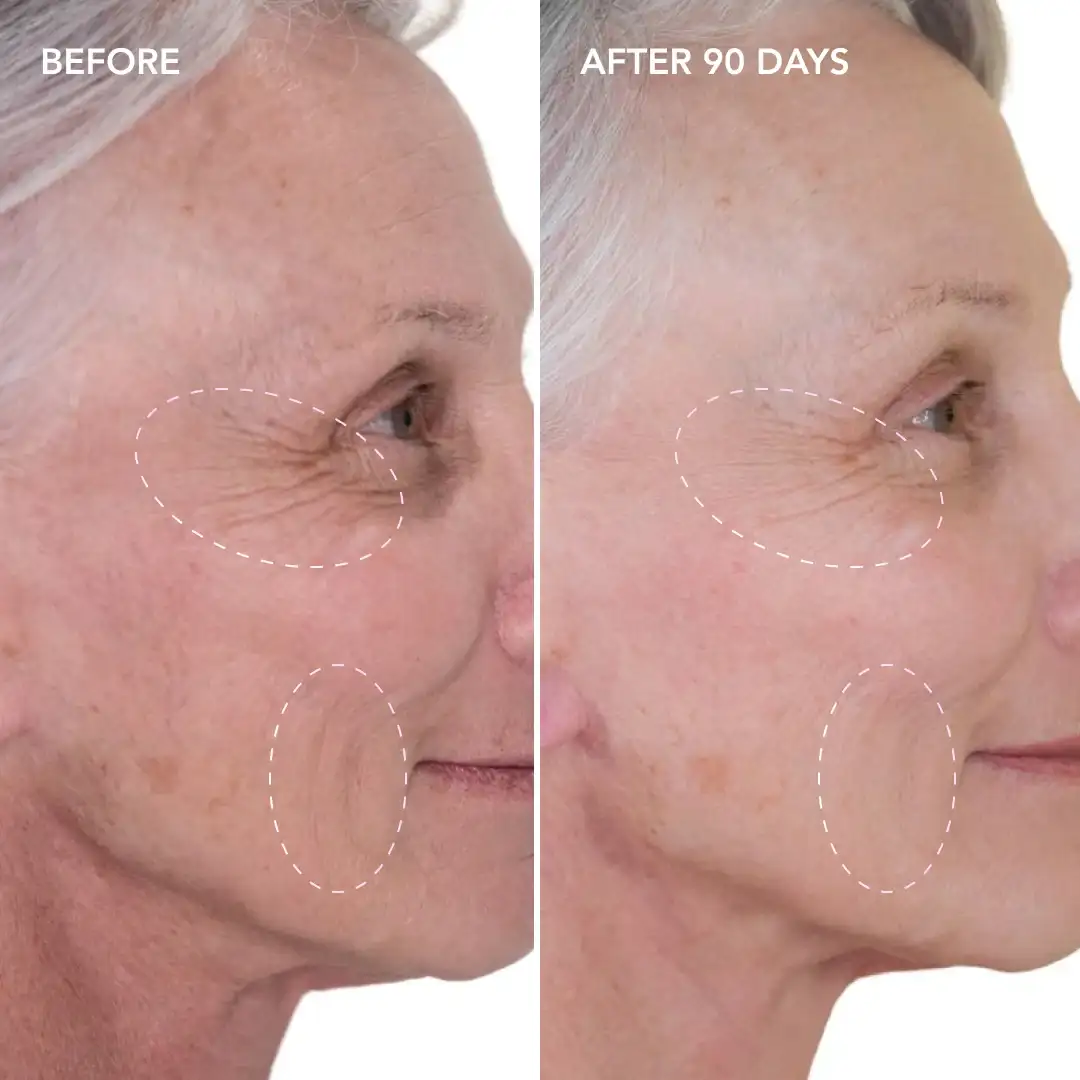 When will you see results Waltham Cross